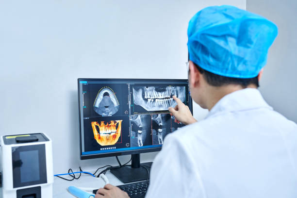 Best Emergency Wisdom Tooth Extraction in Olney, TX